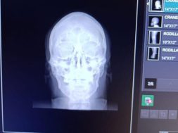 09847B55-A706-4944-99E8-657EE78EBD67