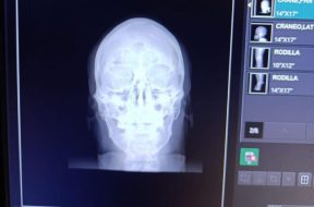 09847B55-A706-4944-99E8-657EE78EBD67